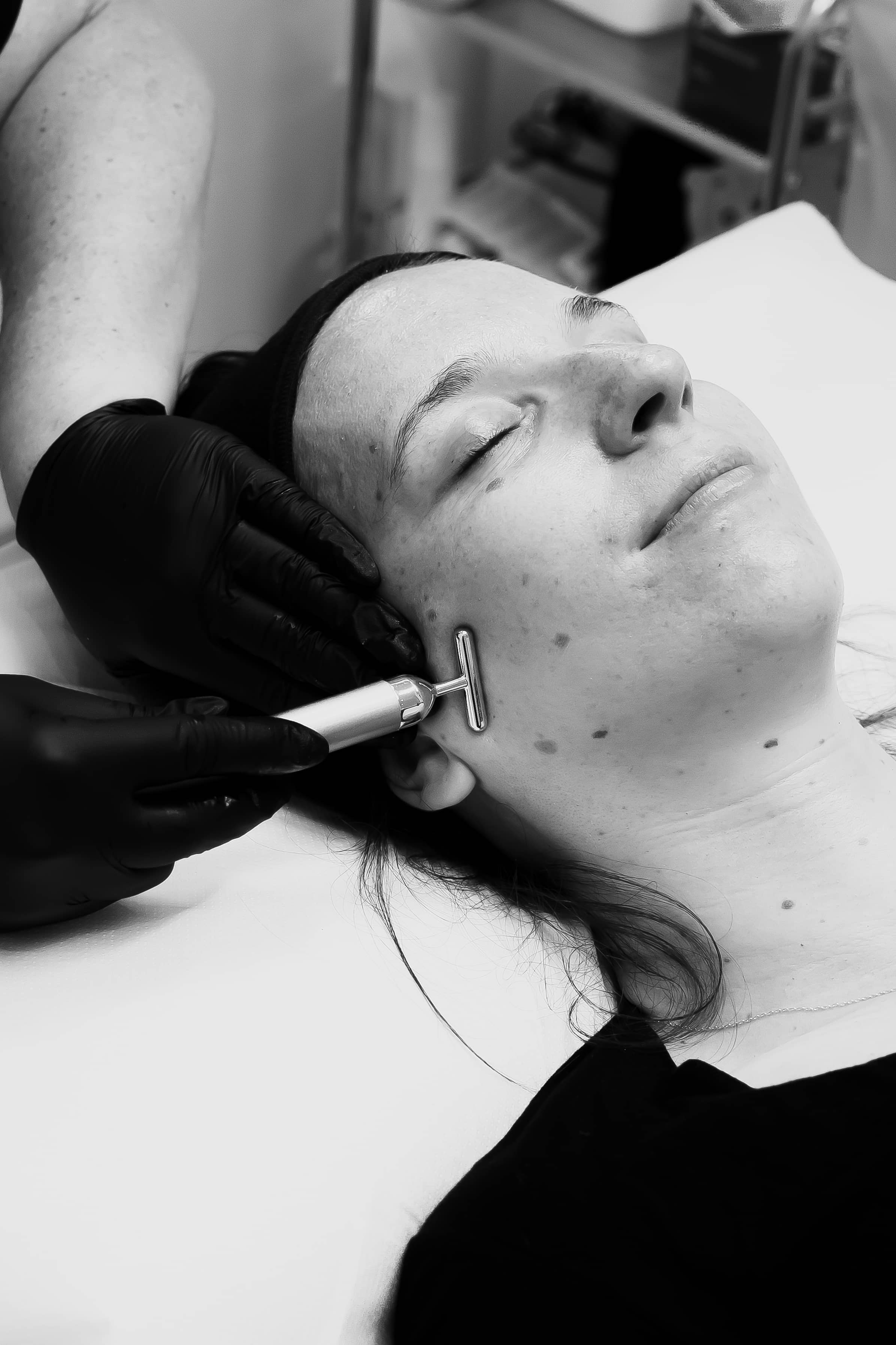 PRP facial rejuvenation at VISO Clinic, Bournemouth