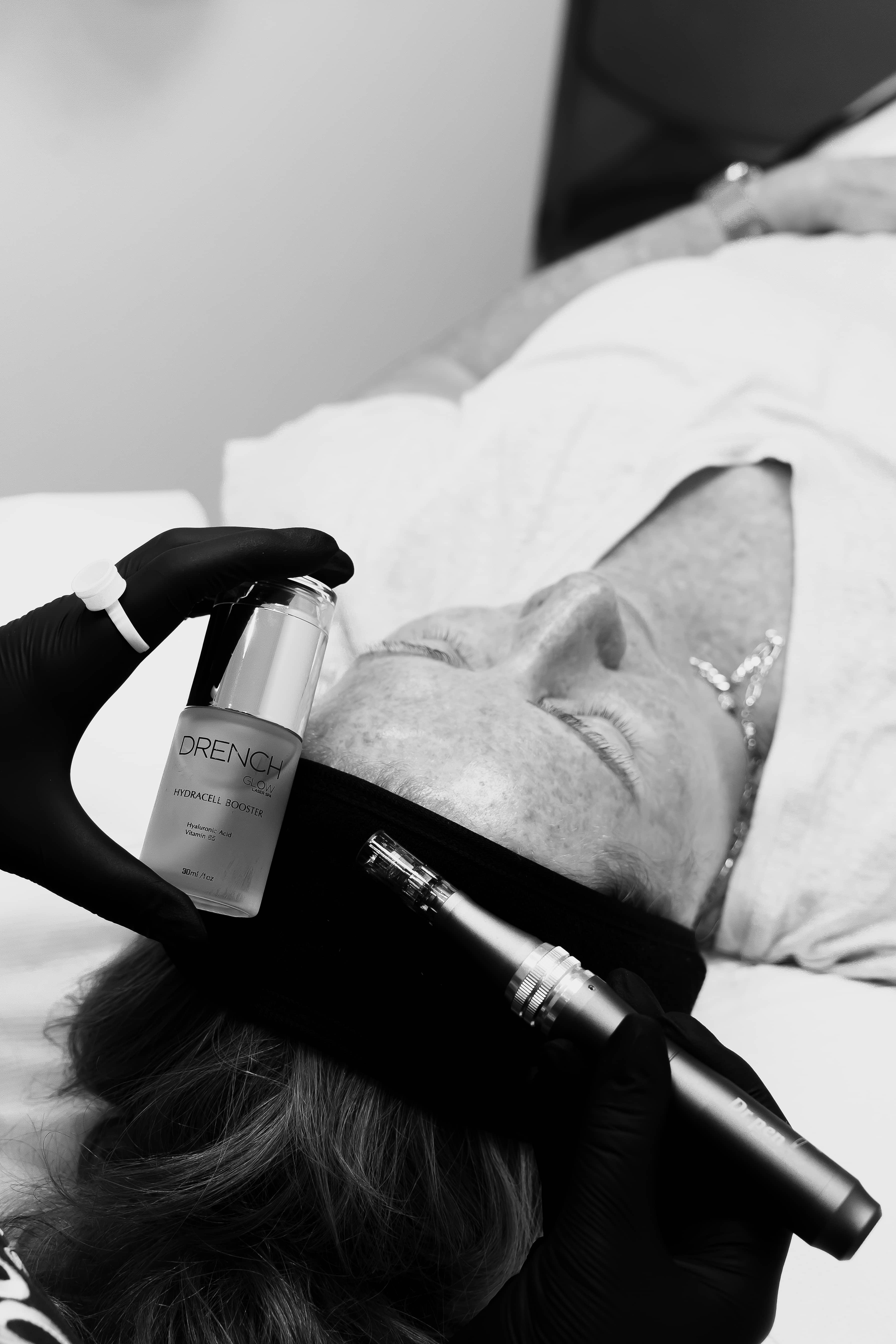 Microneedling treatment at VISO Clinic, Bournemouth