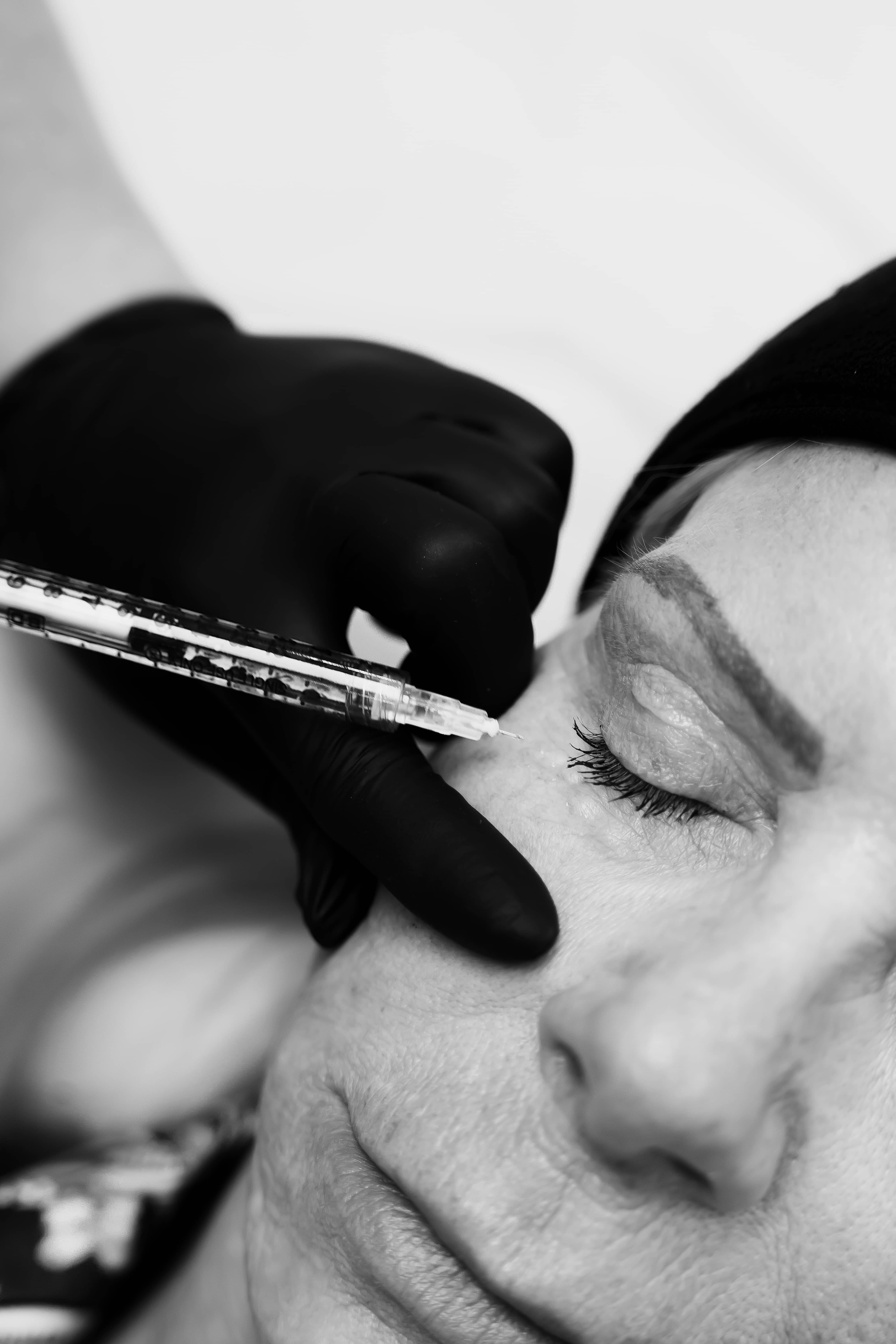 Skin booster treatment at VISO Clinic, Bournemouth
